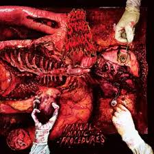 200 Stab Wounds - Manual Manic Procedures (Plutonium Green / Yellow Marble Vinyl) (New Vinyl)
